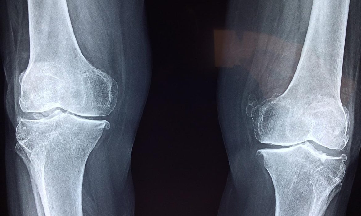 Quelle est la différence entre orthopédie et traumatologie ?