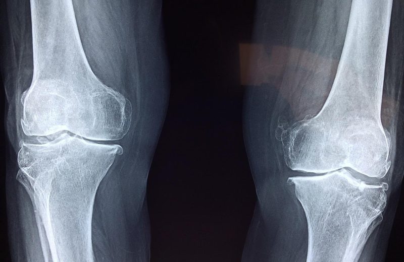 Quelle est la différence entre orthopédie et traumatologie ?